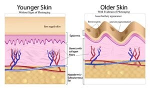 old vs young skin